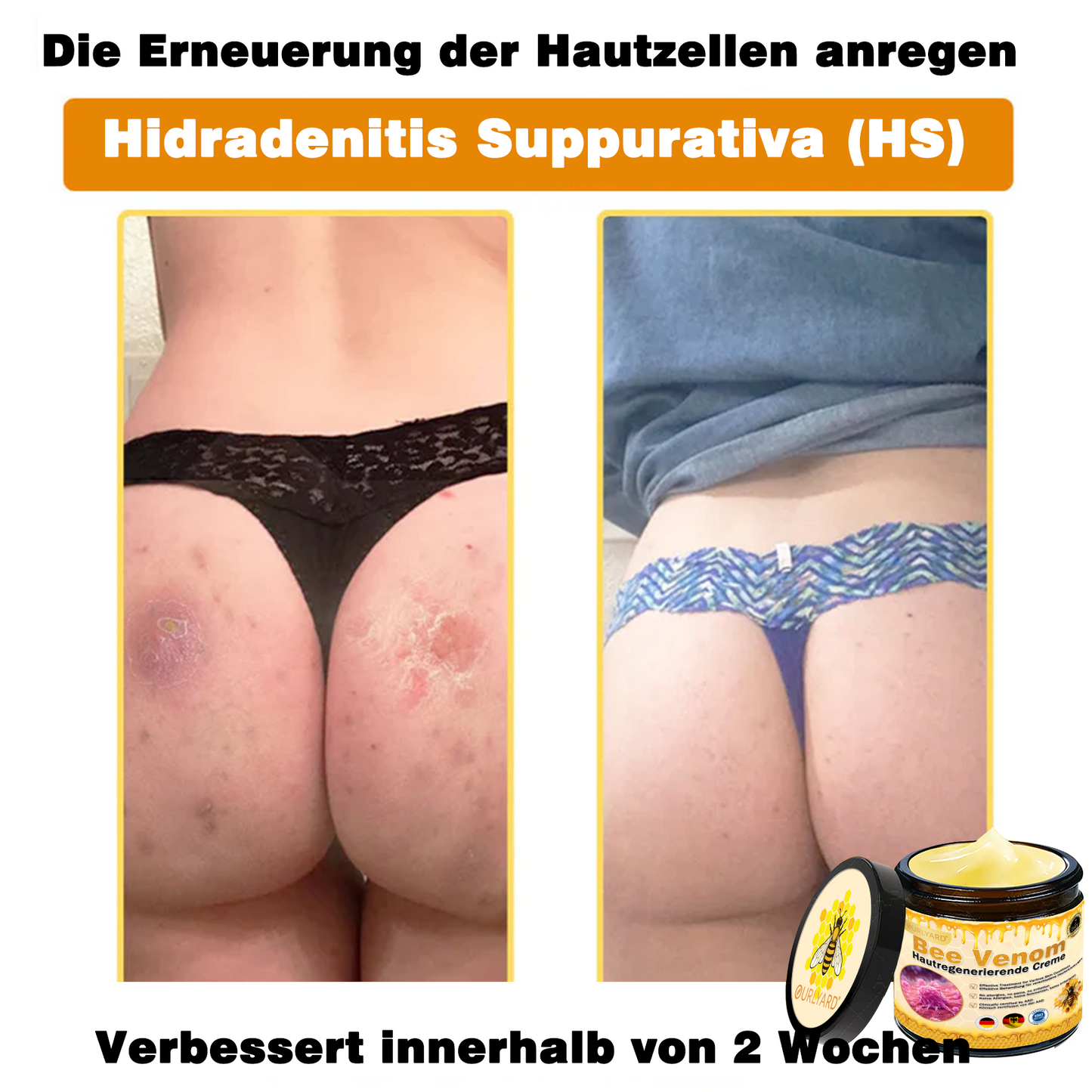 Genieße 30 % Rabatt beim Hinzufügen des zweiten Artikels 🧡