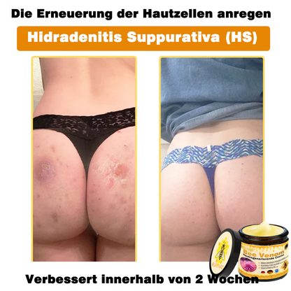 Genieße 30 % Rabatt beim Hinzufügen des zweiten Artikels 🧡