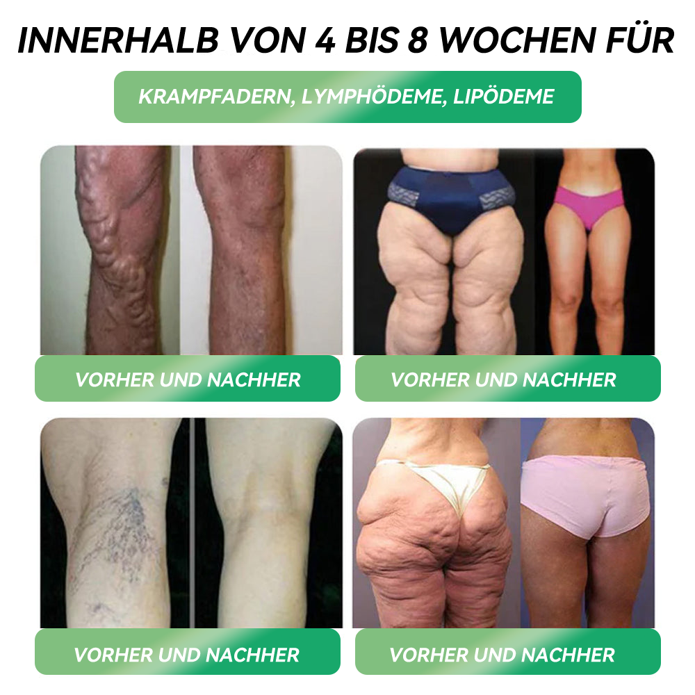 Genieße 30 % Rabatt beim Hinzufügen des zweiten Artikels 🧡